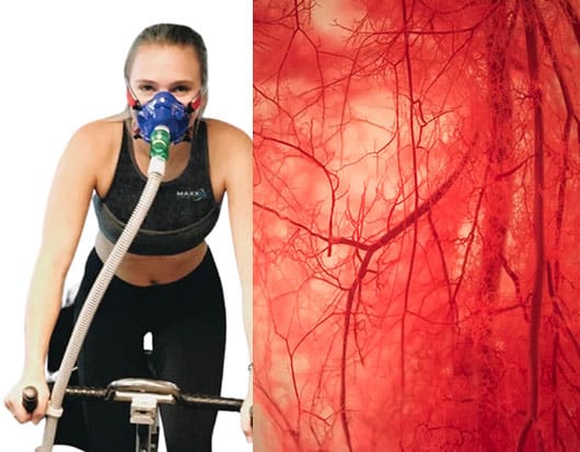 Laser Therapy Houston, TX