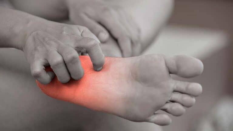NEUROPATHY AND NERVE PAIN IN THE FOOT