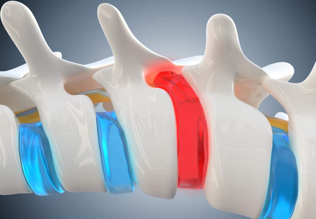 Patient Receiving Spine Therapy Stafford, TX